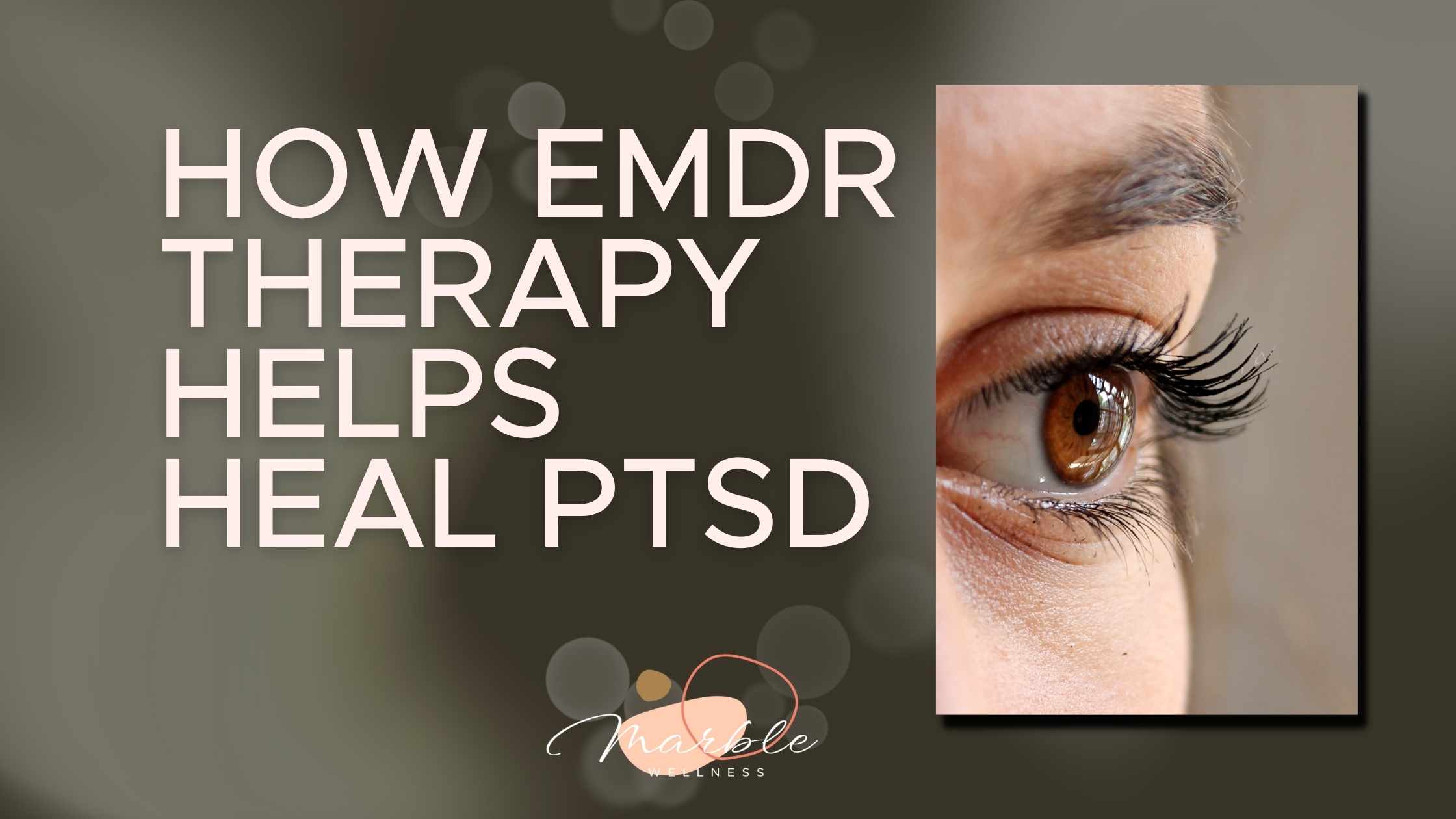 Close up on person's eye with text overlay "How EMDR Therapy Helps Heal From PTSD" from a PTSD therapist in Ballwin, MO. Virtual EMDR in Missouri is available here!